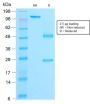 Catenin, beta (CTNNB1) (rCTNNB1/2173), CF640R conjugate, 0.1mg/mL