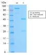 Bcl-2 (Apoptosis & Follicular Lymphoma Marker) (BCL2/2210R), CF640R conjugate, 0.1mg/mL