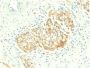 CD56 / NCAM1 / NKH1 (Neuronal Cell Marker) (NCAM1/2217R), CF640R conjugate, 0.1mg/mL