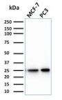 Calcineurin B homologous protein 2 / HCC Antigen 520(CPTC-CHP2-1), CF640R conjugate, 0.1mg/mL