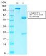 Rb1 (Tumor Suppressor Protein) (RB1/2313R), CF640R conjugate, 0.1mg/mL