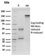 RET Proto-oncogene(RET/2599), CF640R conjugate, 0.1mg/mL