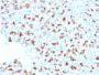BARX1 (Prognostic Biomarker in Hepatocellular Carcinoma)(BARX1/2759), CF640R conjugate, 0.1mg/mL