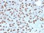 BARX1 (Prognostic Biomarker in Hepatocellular Carcinoma)(BARX1/2760), CF640R conjugate, 0.1mg/mL