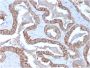 Cytokeratin 15 (Esophageal Squamous Cell Carcinoma Marker)(KRT15/2957), CF640R conjugate, 0.1mg/mL