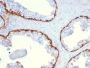 Cytokeratin 15 (Esophageal Squamous Cell Carcinoma Marker)(KRT15/2959), CF640R conjugate, 0.1mg/mL