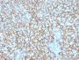 MCAM (Melanoma Cell Adhesion Molecule) / MUC18 / CD146(MCAM/3048), CF640R conjugate, 0.1mg/mL