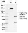 APC / Adenomatous Polyposis Coli / FAP (Tumor Suppressor)(ALi 12-28), CF640R conjugate, 0.1mg/mL