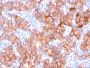 HER-2 / c-erbB-2 / neu / CD340(ERBB2/3079), CF640R conjugate, 0.1mg/mL