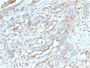 PD-L1 / PDCD1LG1 / CD274 / B7-H1 (Cancer Immunotherapy Target) (PDL1/2746), CF543 conjugate, 0.1mg/mL