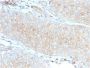 PD-L1 / PDCD1LG1 / CD274 / B7-H1 (Cancer Immunotherapy Target) (PDL1/2746), CF543 conjugate, 0.1mg/mL