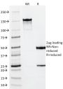 Vimentin(VM452), CF647 conjugate, 0.1mg/mL
