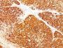 Melanoma Marker(HMB45 + A103 + T311), CF647 conjugate, 0.1mg/mL