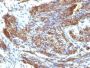 Caldesmon, HMW (h-Caldesmon)(CALD1/820), CF647 conjugate, 0.1mg/mL