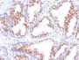 Androgen Receptor(DHTR/882), CF647 conjugate, 0.1mg/mL