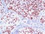 TTF-1 / NKX2.1(8G7G3/1 + NX2.1/690), CF647 conjugate, 0.1mg/mL