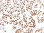 TTF-1 / NKX2.1(8G7G3/1 + NX2.1/690), CF647 conjugate, 0.1mg/mL