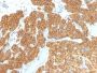 PTH / Parathyroid Hormone (N-Terminal)(PTH/911), CF647 conjugate, 0.1mg/mL