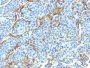 NGFR (Nerve Growth Factor Receptor)(NTR/912), CF647 conjugate, 0.1mg/mL