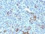 NGFR (Nerve Growth Factor Receptor)(NGFR5 + NTR/912), CF647 conjugate, 0.1mg/mL