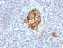 Chromogranin A(CGA414 + CGA/777 + CGA/798), CF647 conjugate, 0.1mg/mL