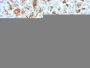 Cytokeratin 19(KRT19/799 + KRT19/800), CF647 conjugate, 0.1mg/mL