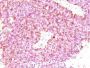 Chromogranin A(LK2H10 + PHE5 + CGA414), CF647 conjugate, 0.1mg/mL