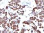 Thyroglobulin(TGB04 + TGB05), CF647 conjugate, 0.1mg/mL