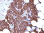 PTH (Parathyroid Hormone) (N & C Terminal) (3H9 + PTH/1175), CF647 conjugate, 0.1mg/mL