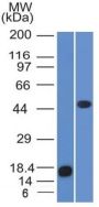 Adipophilin / Perilipin-2 (Marker of Obesity) (ADFP/1365), CF647 conjugate, 0.1mg/mL