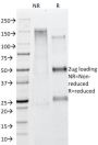 Adipophilin / Perilipin-2 (Marker of Obesity) (ADFP/1365), CF647 conjugate, 0.1mg/mL