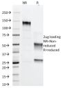 Adipophilin / Perilipin-2 (Marker of Obesity) (ADFP/1366), CF647 conjugate, 0.1mg/mL