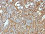 Ep-CAM / CD326 (Extracellular Domain) (Epithelial Marker) (EGP40/1372), CF647 conjugate, 0.1mg/mL