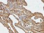 Ep-CAM / CD326 (Extracellular Domain) (Epithelial Marker) (EGP40/1372), CF647 conjugate, 0.1mg/mL