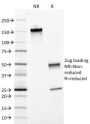 Ep-CAM / CD326 (Extracellular Domain) (Epithelial Marker) (EGP40/1372), CF647 conjugate, 0.1mg/mL