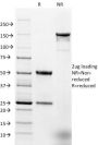 Ep-CAM / CD326 (Extracellular Domain) (Epithelial Marker) (EGP40/1384), CF647 conjugate, 0.1mg/mL