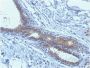 BRCA1 (Breast Marker) (BRCA1/1398), CF647 conjugate, 0.1mg/mL
