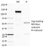 BRCA1 (Breast Marker) (BRCA1/1398), CF647 conjugate, 0.1mg/mL
