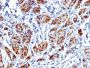 Caldesmon, HMW (h-Caldesmon) (Smooth Muscle Marker) (CALD1/1424R), CF647 conjugate, 0.1mg/mL