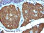 NSE gamma (Neuron Specific Enolase, gamma) (Neuroendocrine Marker) (ENO2/1462), CF647 conjugate, 0.1mg/mL