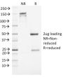 NSE gamma (Neuron Specific Enolase, gamma) (Neuroendocrine Marker) (ENO2/1462), CF647 conjugate, 0.1mg/mL