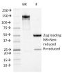 ATRX / RAD54 (Alpha Thalassemia Mental Retardation)(23c), CF647 conjugate, 0.1mg/mL
