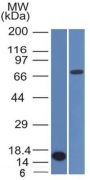 Bcl-6 (Follicular Lymphoma Marker) (BCL6/1475), CF647 conjugate, 0.1mg/mL
