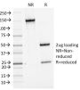 Bcl-6 (Follicular Lymphoma Marker) (BCL6/1475), CF647 conjugate, 0.1mg/mL