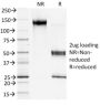 S100A4 (Marker of Tumor Metastasis) (S100A4/1481), CF647 conjugate, 0.1mg/mL