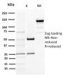DOG-1 / TMEM16A (Gastrointestinal Stromal Tumor Marker) (DG1/1484), CF647 conjugate, 0.1mg/mL