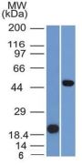 PAX8 (Renal Cell Marker) (PAX8/1491), CF647 conjugate, 0.1mg/mL