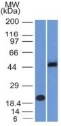 PAX8 (Renal Cell Marker) (PAX8/1492), CF647 conjugate, 0.1mg/mL