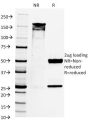 PAX8 (Renal Cell Marker) (PAX8/1492), CF647 conjugate, 0.1mg/mL