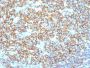 CD20 / MS4A1 (B-Cell Marker) (IGEL/1497R), CF647 conjugate, 0.1mg/mL